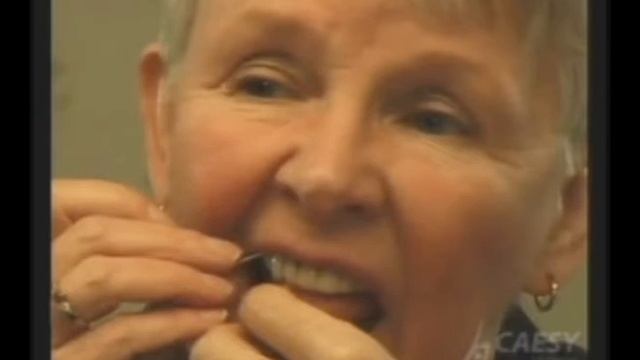 Clean Braces & Bridge work using "Super Floss". Burbank смотреть онлайн