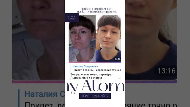 Атоми от пигментации #пигментация #красота #макияж #уход #здоровье #atomy #beautiful #атоми #beaut смотреть онлайн