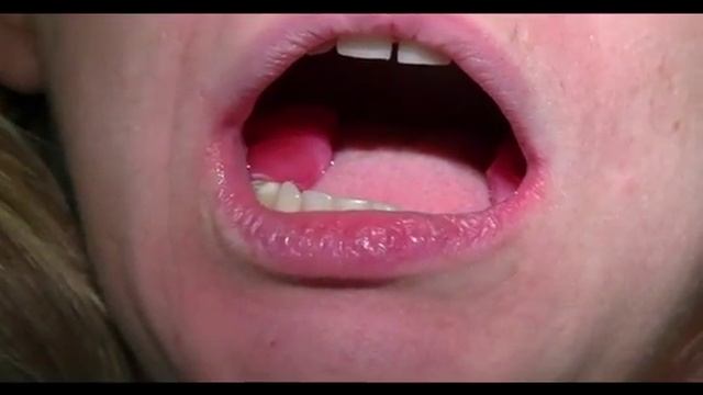 Decompression bite Часть 2 смотреть онлайн