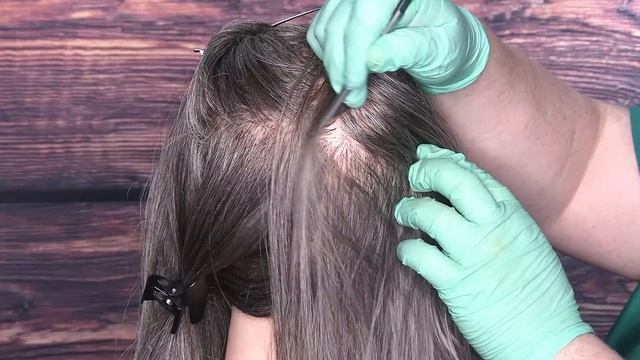 ASMR Lice Check And Treatment (Tweezers, Scalp Treatment, Lice Comb, Whispering) Medical Roleplay