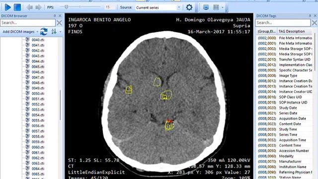 MicroDicom viewer 64 bit unlicensed for commercial use Pictures 2021 12 28 22 35 49 смотреть онлайн