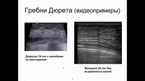 Эхографическая семиотика диффузной мастопатии