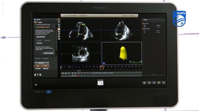 How To Perform 3D Quantification Using Philips QLAB 3DQA Application смотреть онлайн
