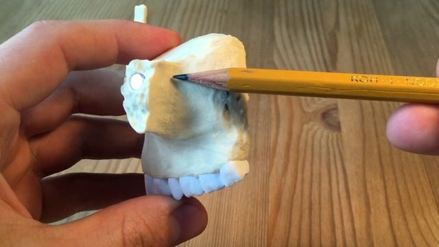 Верхняя челюсть. Os maxilla. Анатомия. смотреть онлайн