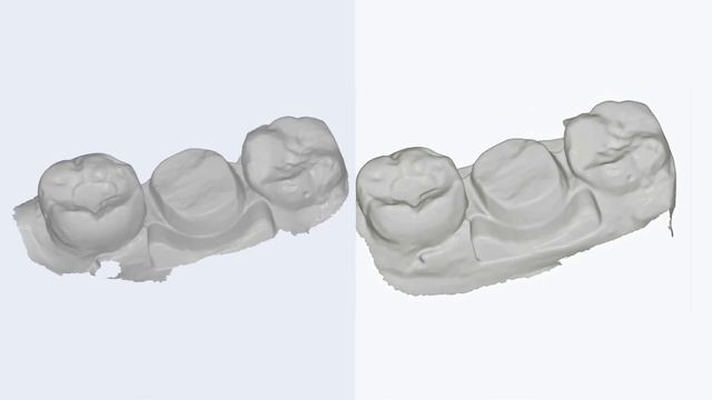 What's New in BLZ Dental Intraoral Scanner Software V2.8? смотреть онлайн