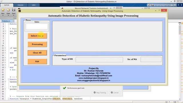 Diabetic Retinopathy Detection Using Image Processing Matlab Project with Source Code смотреть онлайн