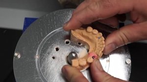 Зубные коронки на импланты: обзор вариантов, креплений и этапов изготовления.