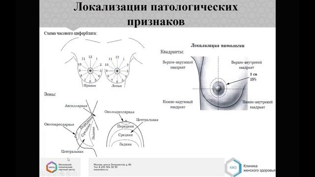 МАММОГРАФИЯ Лекция «Система оценки BI RADS, использование в повседневной практике» 2 смотреть онлайн