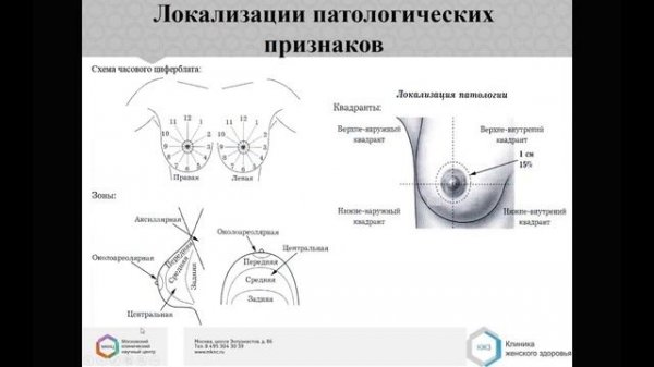 МАММОГРАФИЯ Лекция «Система оценки BI RADS, использование в повседневной практике» 2