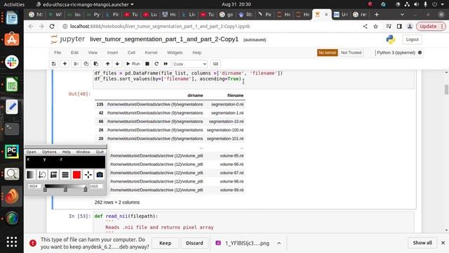 Automatic Liver and Tumor Segmentation from CT-scan Images using U-Net & ResNet |Deep Learning| смотреть онлайн