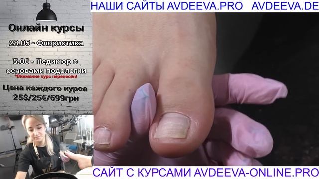ПЕДИКЮР ОНЛАЙН. Виктория Авдеева смотреть онлайн