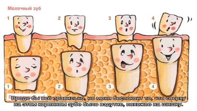 У ребенка вздутие десны между молочным и коренным зубами смотреть онлайн