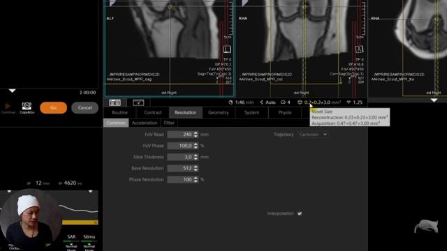 MRI – MATRIX BACK TO BASIC смотреть онлайн