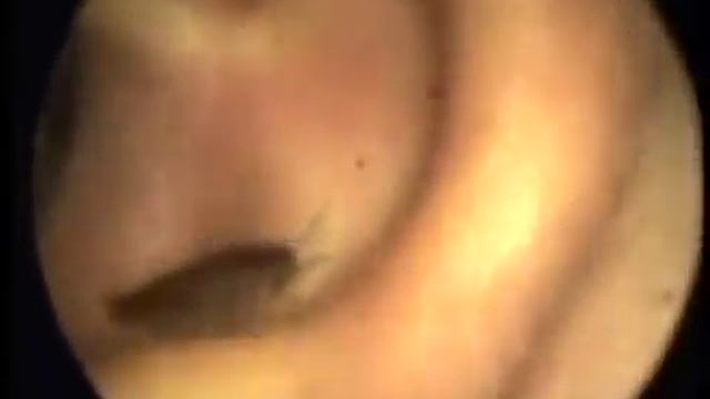 кусачая тварь в ухе