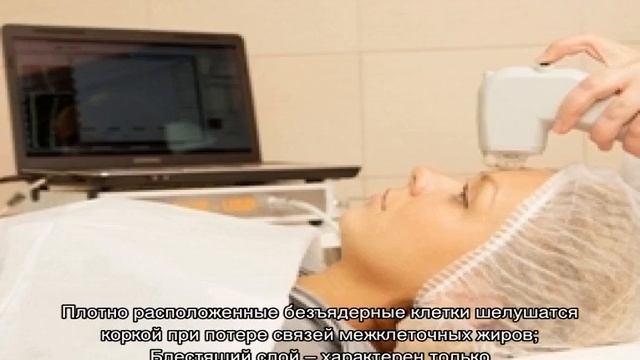 Строение кожи лица в косметологии: схема смотреть онлайн