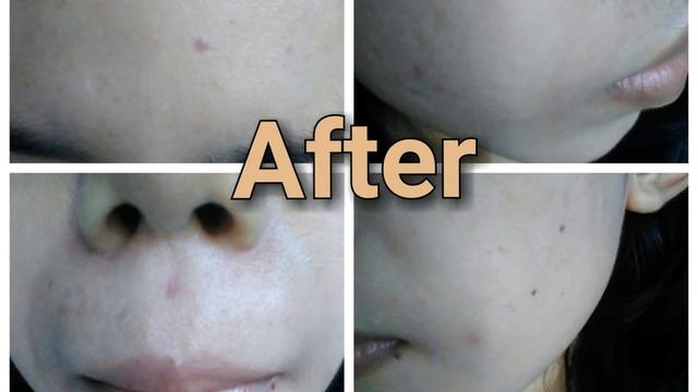 MIZON ALL IN ONE SNAIL REPAIR CREAM REVIEW [BAHASA] with English Sub смотреть онлайн