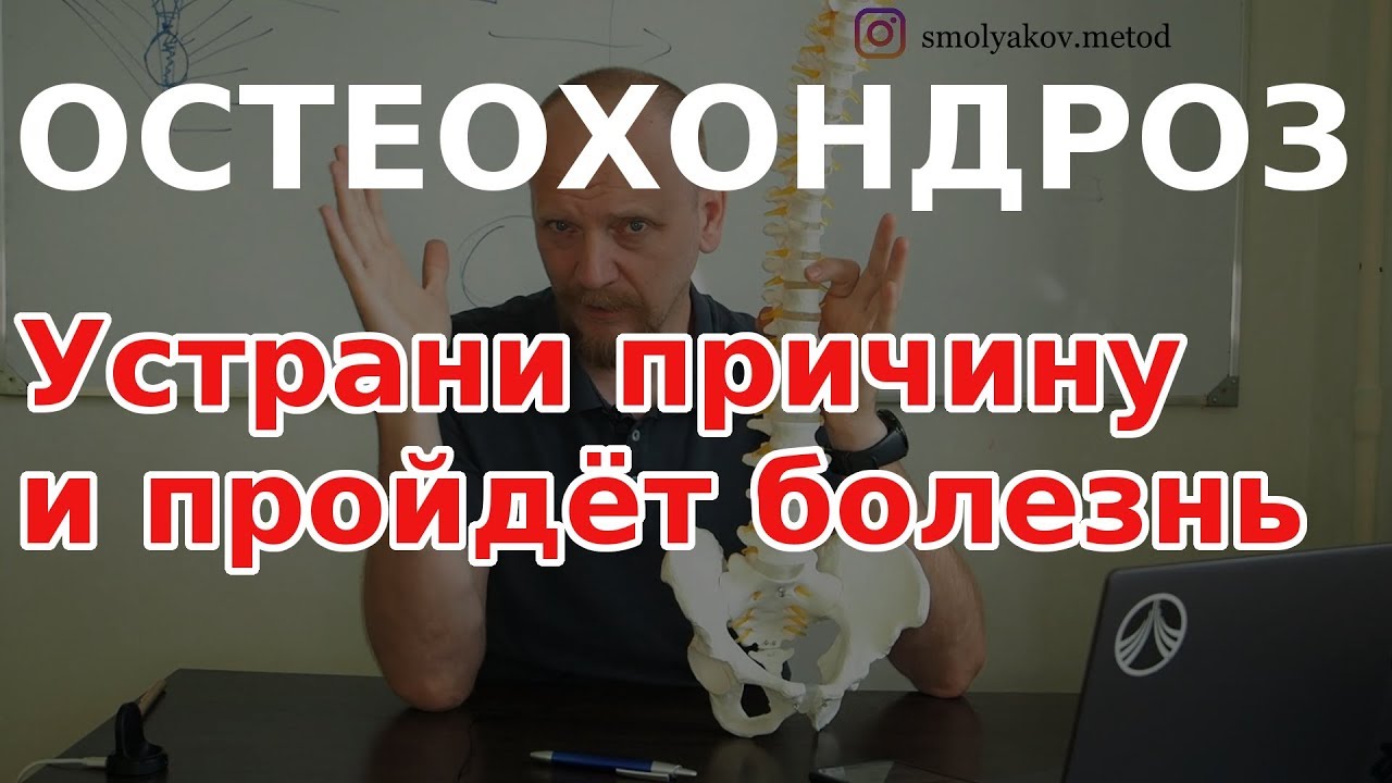 Шейный остеохондроз причина. Как лечить шейный остеохондроз?