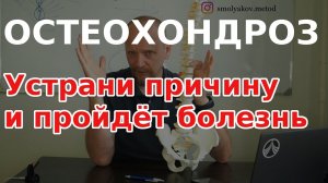 Шейный остеохондроз причина. Как лечить шейный остеохондроз?
