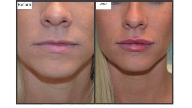 Dr William Carter - Medical Cosmetics Lancaster PA смотреть онлайн