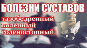 ? Болезни суставов: тазобедренный, коленный, голеностопный; артрит, артроз