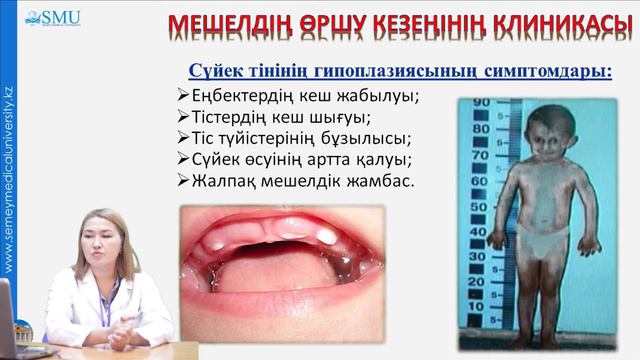 Рахит смотреть онлайн