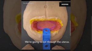 Шикарное видео о кесарево сечении для детей и интересующихся.