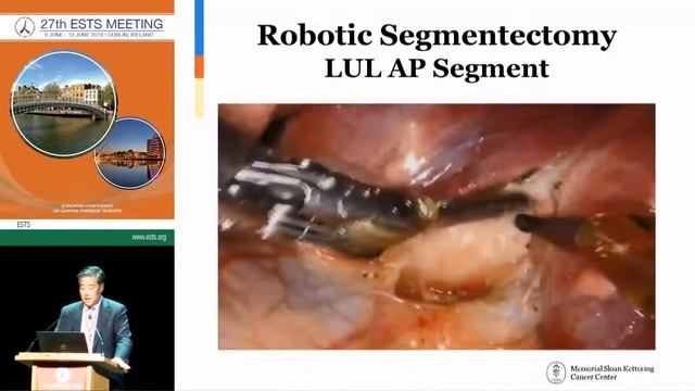 Bernard Park | Robotic segmentectomy: technique and results смотреть онлайн
