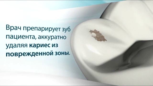 Керамические реставрации за одно посещение - CEREC смотреть онлайн