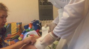 Наложение пластикового гипса на ногу