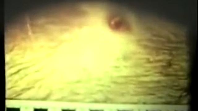 Судебно-медицинская ГИСТОЛОГИЯ 1988( 16+) смотреть онлайн