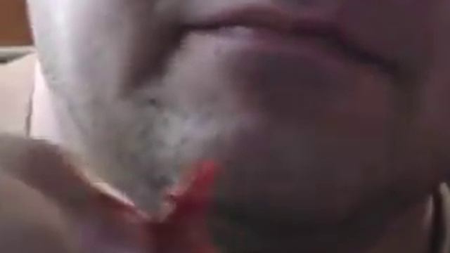 удаление зуба самостоятельно смотреть онлайн