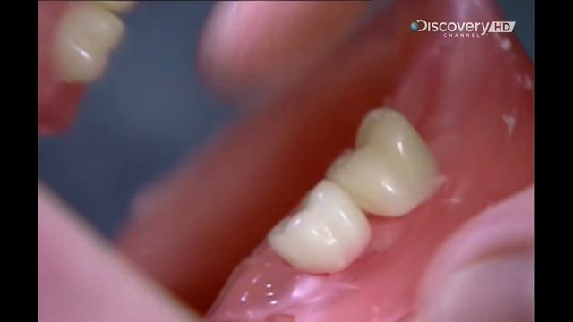 Искусственные зубы 2002 год - Как это работает? (How it's made?) Как это сделано? смотреть онлайн