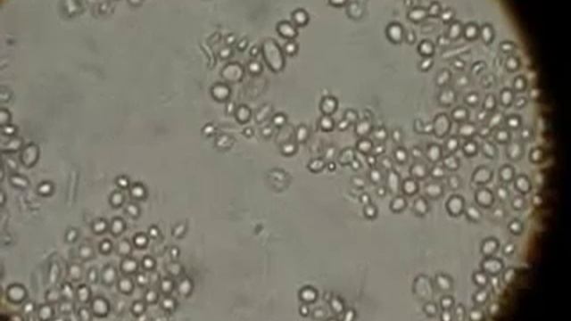 Дрожжи под микроскопом. Дрожжи грибы. смотреть онлайн