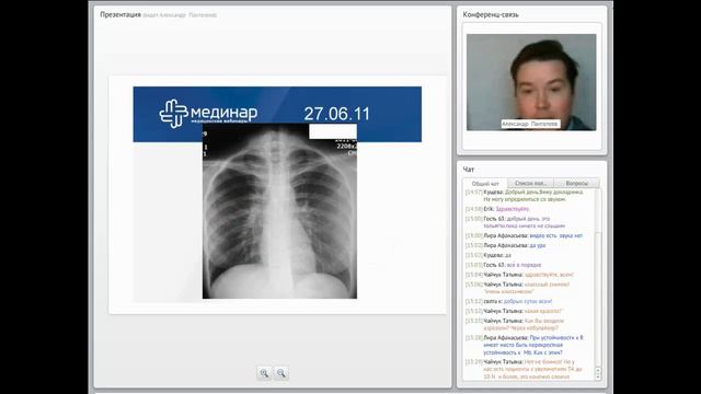 Генерализованные формы туберкулёза у больных ВИЧ-инфекцией смотреть онлайн