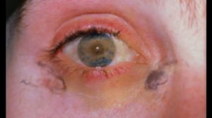 Причины заболеваний глаз