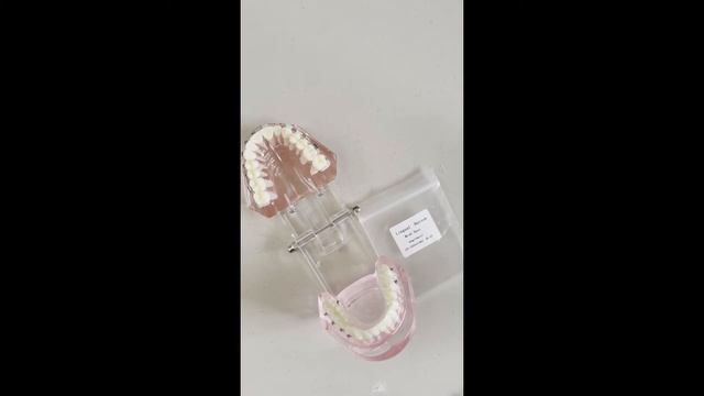 The Boot Strap Technique for Aligner Extrusion and Posterior Openbite with Buttons смотреть онлайн