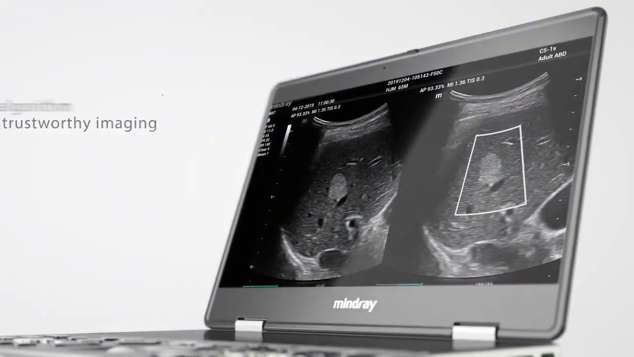 Mindray MX7 смотреть онлайн