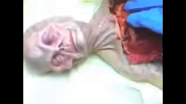 Вскрытие инопланетянина. Слабонервным не смотреть! UFO Alien Autopsy 2015 смотреть онлайн