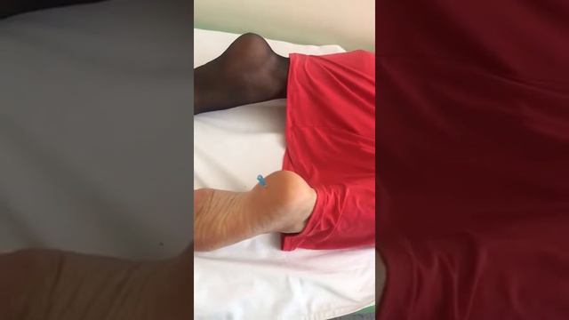 Лечение пяточной шпоры https://www.instagram.com/?hl=ru смотреть онлайн