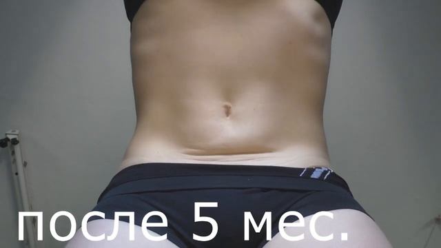 Вакуум живота. До и После. Результат за 5 месяцев. смотреть онлайн