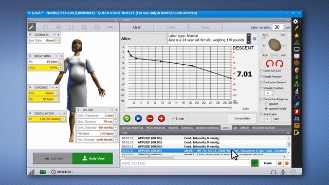 NOELLE S574.100 | S575.100 | S576.100 - GIGA Event Logging Debriefing - Part 15 смотреть онлайн