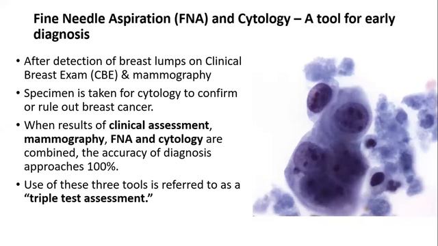 Clinical Presentation, Diagnosis & Staging of Breast Cancer Video смотреть онлайн