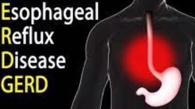 manfaat minum air putih dipagi hari Setelah Bangun Tidur смотреть онлайн