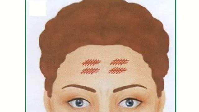 Мезотерапия Мурманск