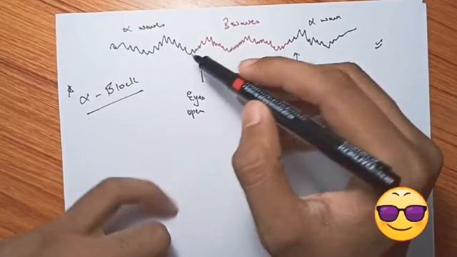 EEG || Or Electroencephalography|| CNS || Physiology|| In Hindi || By Ashish Agrawal