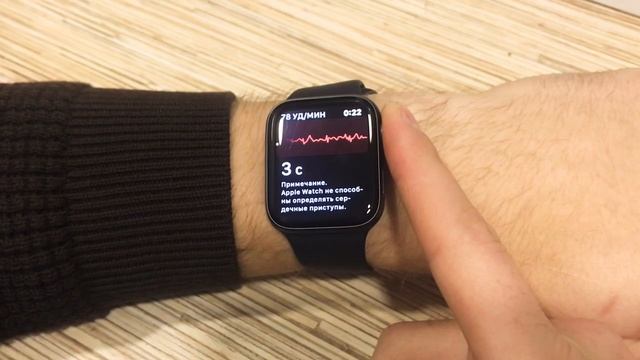 ЭКГ Apple Watch Series 4 смотреть онлайн