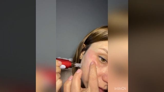 Мезотерапия дома, дермапен