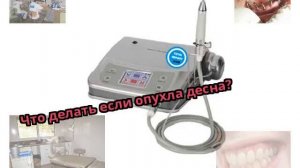 Что делать если опухла десна?