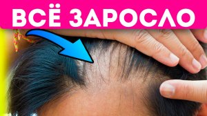 Из-за этого выпадают волосы у мужчин и женщин! Как прекратить выпадение волос и восстановить рост