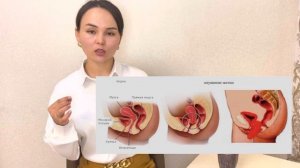 Қынапты тарылту жолдары/плазмолифтинг/кегель жаттығуы/нитевой лифтинг#кегель#қынаптанжелшығу#